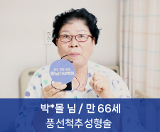 박0몰 치료후기